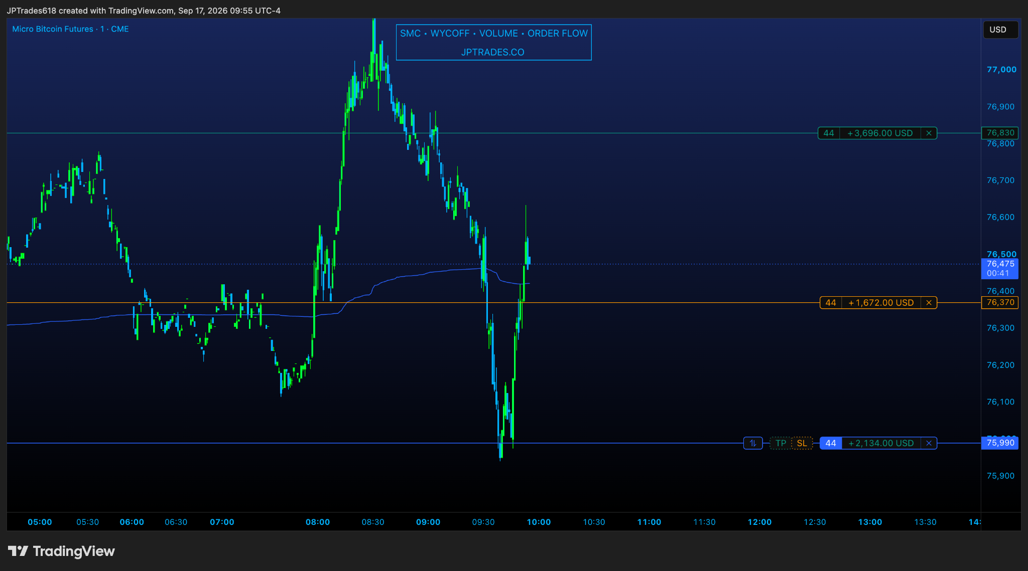 Trade Management